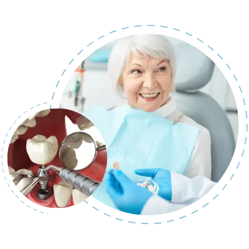 2-3-uye-implantlar