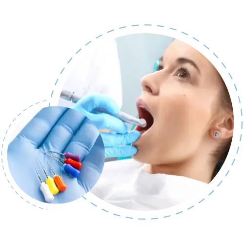 endodonti-tedavileri