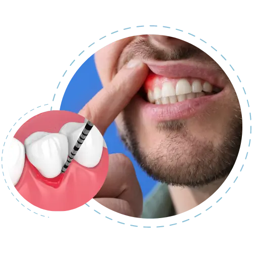 periodontal-tedaviler